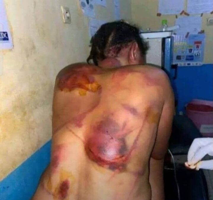 COMMUNIQUÉ DE LA FONDATION OLYMPIA JUJITSU CAMEROUN (FOJCAM) : STOP AUX FÉMINICIDES!